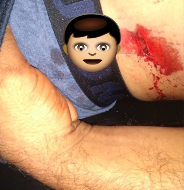 Motociclista muere al caer de motocicleta