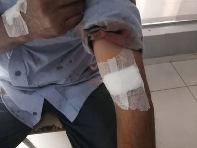 Hieren durante asalto a un vendedor en la Costanera  - Nacionales - ABC Color