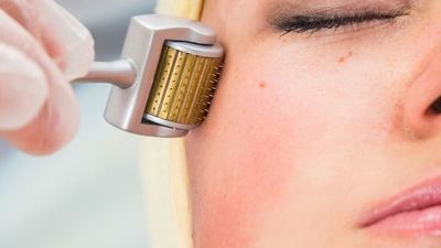 Las microagujas: la herramienta casera para el cutis que se postula ser la favorita del 2021