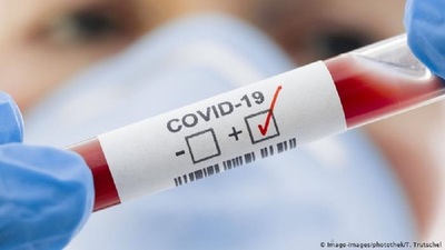 Salud Pública reporta 1.611 nuevos casos y 44 muertes por Covid-19