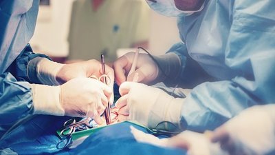 Según estudio, conviene esperar siete semanas para una cirugía en un paciente que tuvo COVID | Ñanduti
