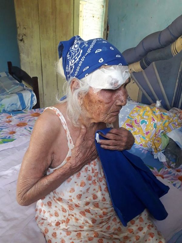 Piden asistencia sanitaria domiciliaria para anciana en Puerto Pinasco - Nacionales - ABC Color
