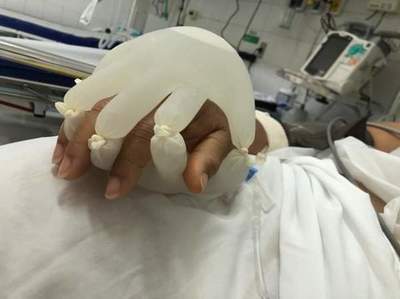 Enfermera crea guantes especiales para “acompañar” a pacientes con COVID-19 | Ñanduti
