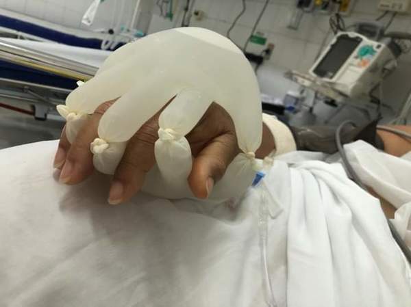 Enfermera crea guantes especiales para “acompañar” a pacientes con COVID-19 | Ñanduti