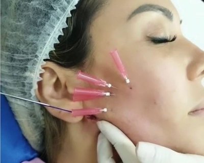 Crónica / Mañami cómo Ruth elimina sus arrugas