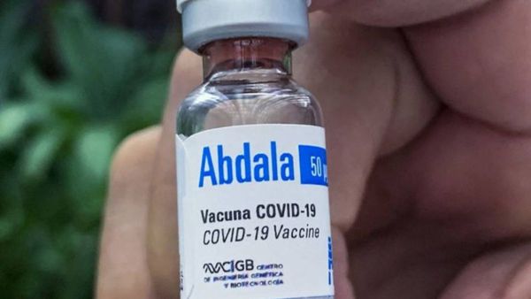 Venezuela producirá la vacuna cubana anticovid Abdala