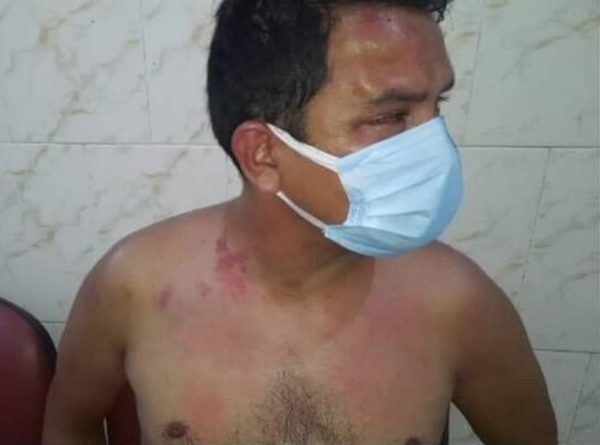 Fiscalía de Derechos Humanos investiga posible tortura a detenido por la Policía