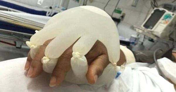 “La mano de Dios”: la técnica de una enfermera para dar consuelo a los pacientes con COVID-19