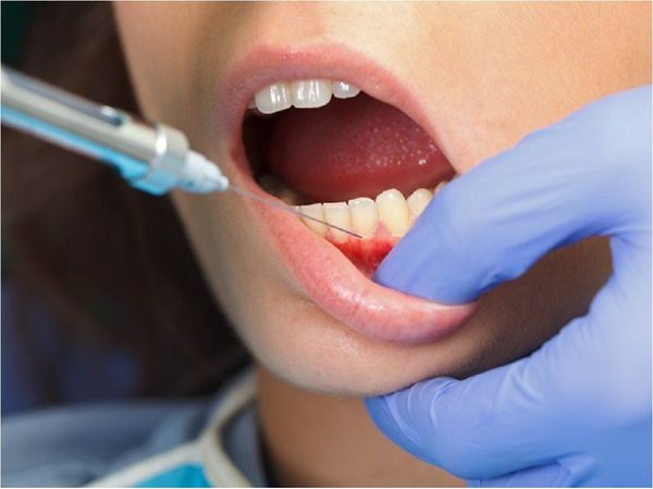 Experto en salud dental habla de "cadena de errores" tras muerte de joven