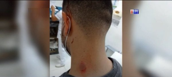 Motochorros balean a un joven en Fernando de la Mora | Noticias Paraguay