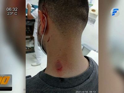 Motochorros disparan a un joven que no quiso entregar su celular y billetera