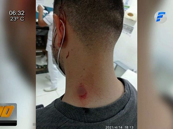 Motochorros disparan a un joven que no quiso entregar su celular y billetera