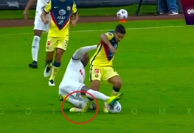 Tras impactante lesión de López, América hace un pedido especial