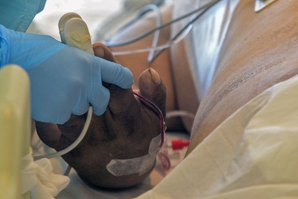 Sistema de salud de Chile en su momento más crítico por casos de coronavirus - Mundo - ABC Color
