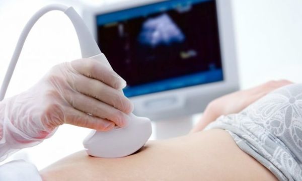 Embarazadas llegan a UTI tras baby showers - Nacionales - ABC Color