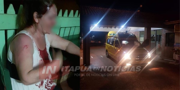 MUJER DE 48 AÑOS DENUNCIÓ QUE SU NOVIO DE 22 AÑOS LA GOLPEÓ SALVAJEMENTE