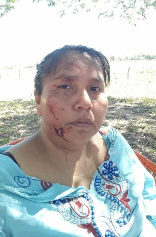 Lideresa indígena denuncia que volvió a ser amenazada y pide intevención de las instituciones | Ñanduti
