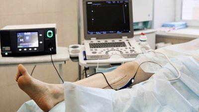 ¿Qué es el tromboembolismo venoso y cómo afecta a los pacientes con COVID? | Ñanduti
