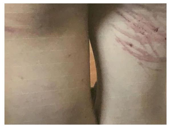 Garroteó a su hijastro "porque tomó agua antes de la merienda"