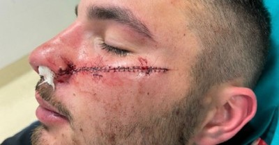 Repartidor quedará marcado para siempre por defender a una adolescente: “Lo volvería a hacer” - C9N