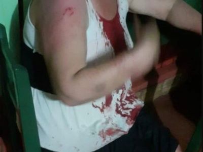 Violencia familiar: Su novio de 22 años le pegó con palo de escoba