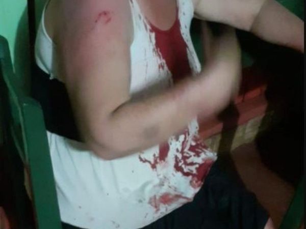 Violencia familiar: Su novio de 22 años le pegó con palo de escoba