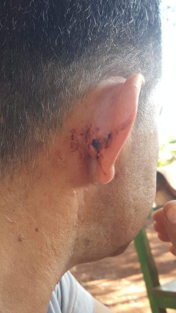 Denuncian a policías por supuesto robo en allanamiento - ABC en el Este - ABC Color