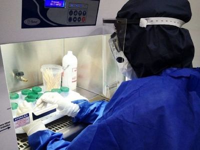 Covid-19: Salud reporta 2.676 nuevos contagios y 72 fallecidos