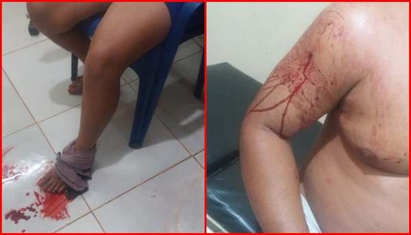 Hombre balea a su pareja y a un testigo tras discusión en Itakyry – Diario TNPRESS