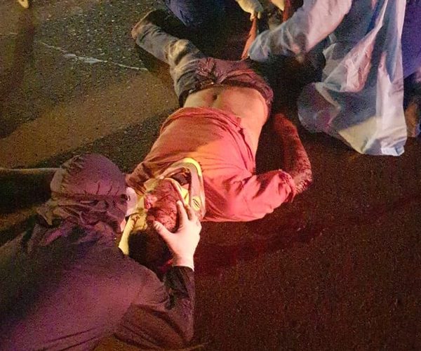 Buscan un Toyota Vitz de color rojo que atropelló a un transeúnte y huyó – Diario TNPRESS