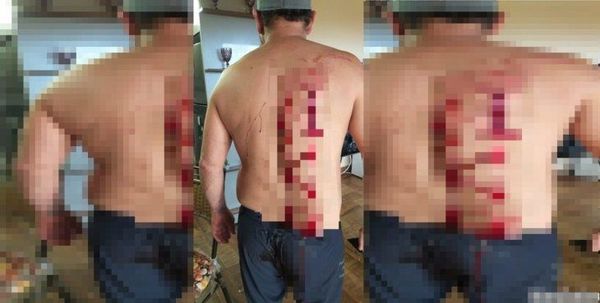 Arrestan a mujer que hirió a su concubino en Presidente Franco - La Clave