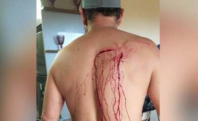 Por celos atacó con un cuchillo y un vaso de vidrio a su esposo
