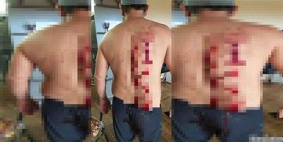 Arrestan a mujer que hirió a su concubino en Presidente Franco