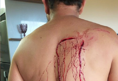 Mujer celosa atacó con un cuchillo y un vaso de vidrio a su esposo - Noticiero Paraguay