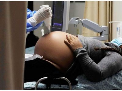 Alerta en Brasil por más fallecimientos de embarazadas
