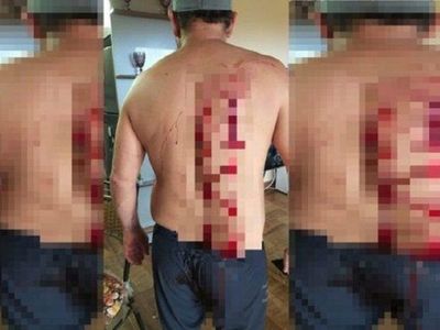 Tajeado con un vaso pidió que no lleven presa a su esposa