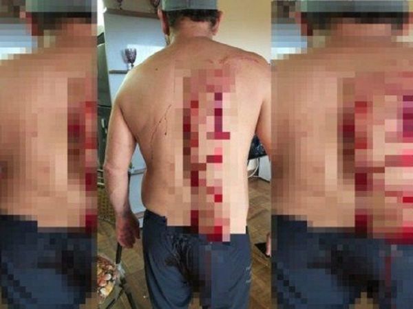 Tajeado con un vaso pidió que no lleven presa a su esposa