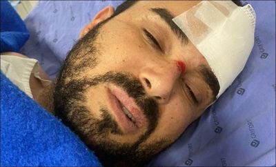 Brasileño baleado en el micro centro de PJC está fuera de peligro
