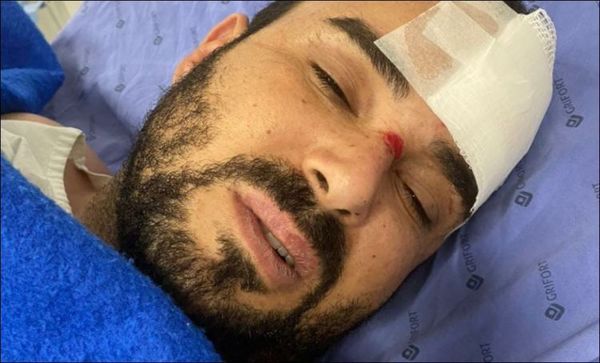 Brasileño baleado en el micro centro de PJC está fuera de peligro