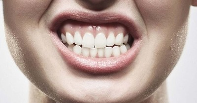 La Nación / Salud bucal: síntomas y tratamiento del bruxismo