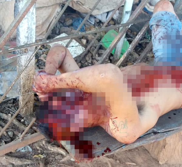 Casi matan a pedrada a un hombre tras discusión en ronda de tragos - La Clave