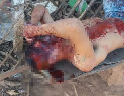 Hombre recibe piedrazo en la cabeza tras discusión en ronda de tragos