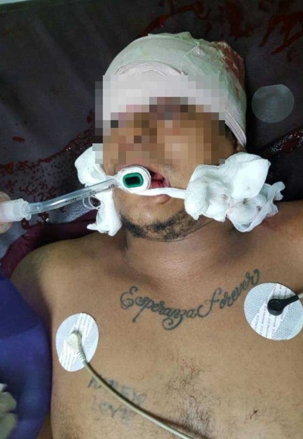 Joven baleado por sicarios muere en Hospital de Traumas de Asunción - La Clave