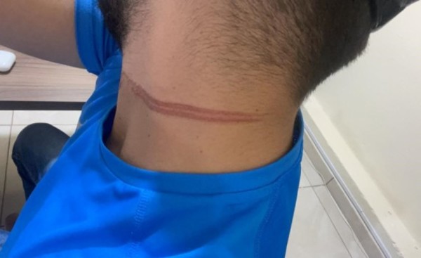 Motociclista casi es ahorcado por cable suelto de la ANDE