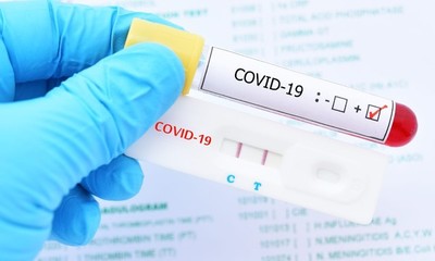 Triste muerte de una embarazada con COVID-19 en Lambaré - SNT