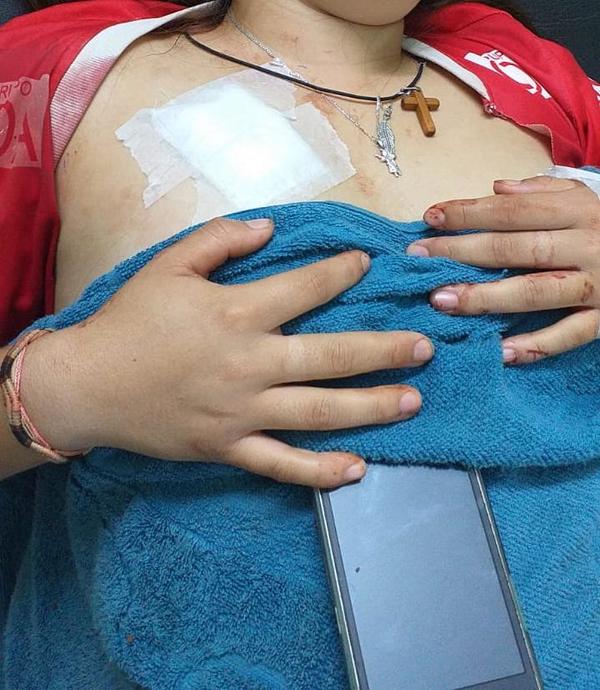 Reportan intento de feminicidio en Ñacunday - La Clave