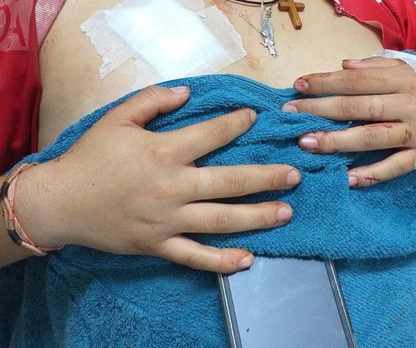 Hombre hiere de tres puñaladas a su novia adolescente