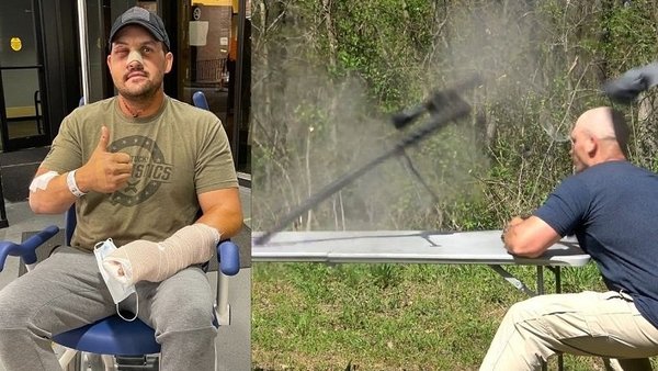 Se grabó cuando le explotó un rifle en la cara: vivió para contarlo | Noticias Paraguay