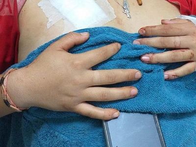 Imputan a pareja de joven víctima de intento de feminicidio