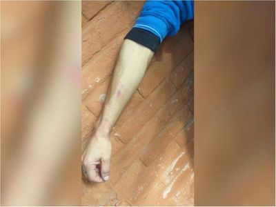 Conductora de Bolt luchó a mordiscos con asaltante